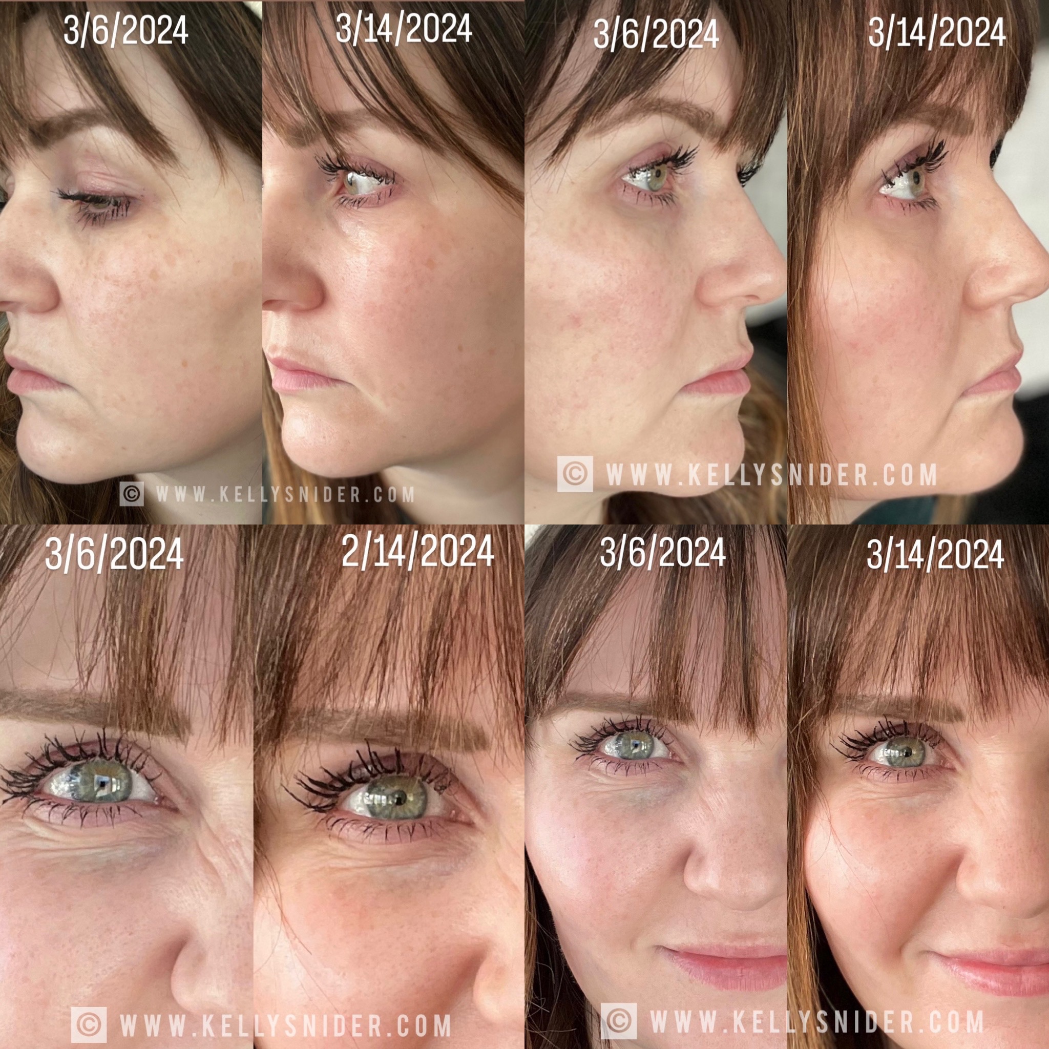 Oliveda Skincare Review: My Honest Take and Shocking Results After 