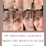 Before and Afters using Oliveda Skincare