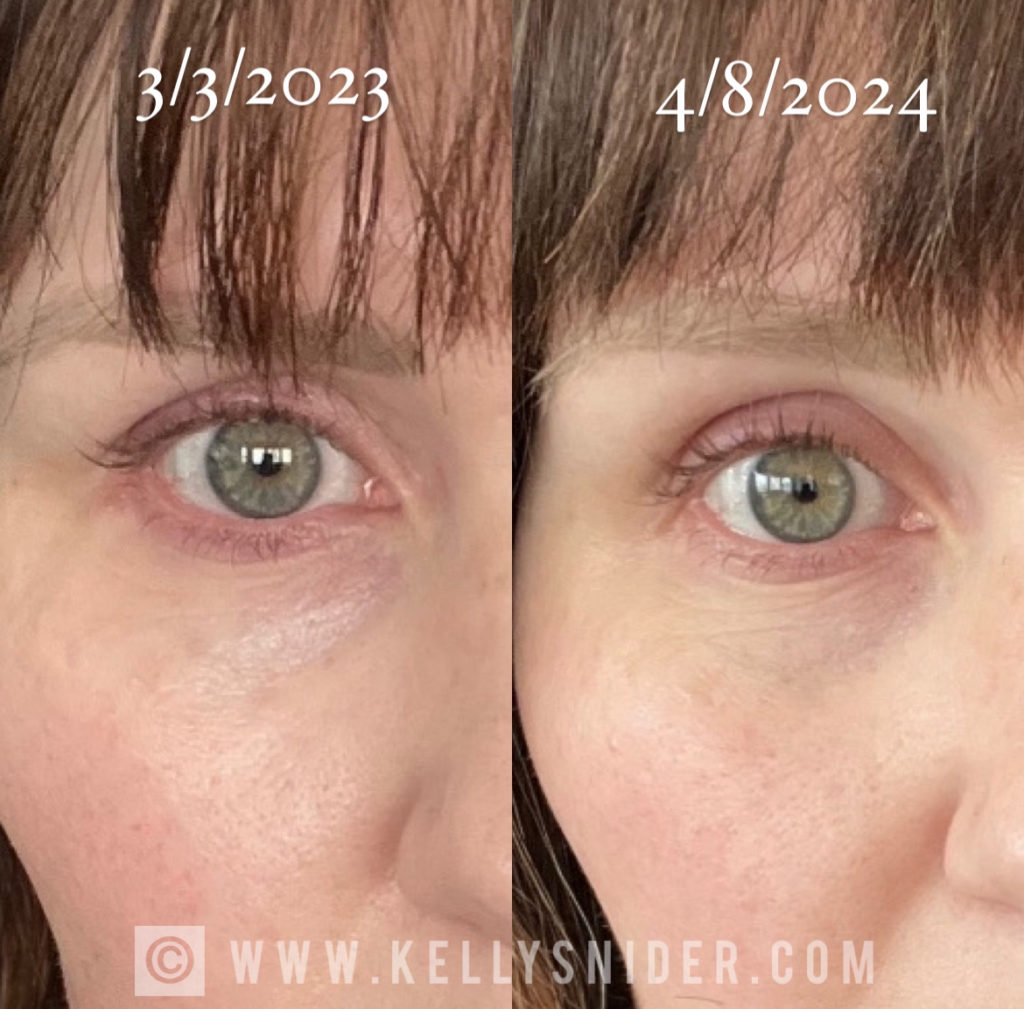 Oliveda Skincare Review: My Honest Take and Shocking Results After Only 8 Days