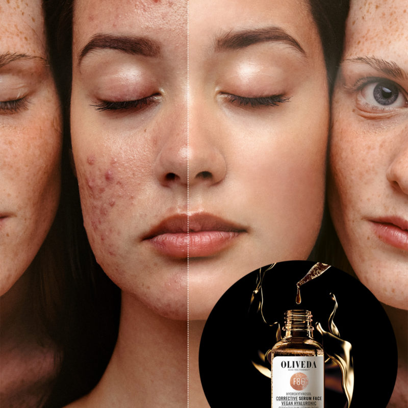 Why Waterless Skincare Is the #1 Beauty Trend This Fall (+ My Oliveda Favorites)